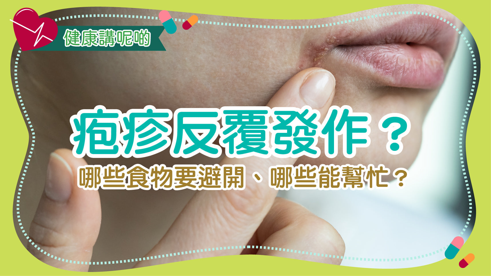 疱疹反覆發作？哪些食物要避開、哪些能幫忙？