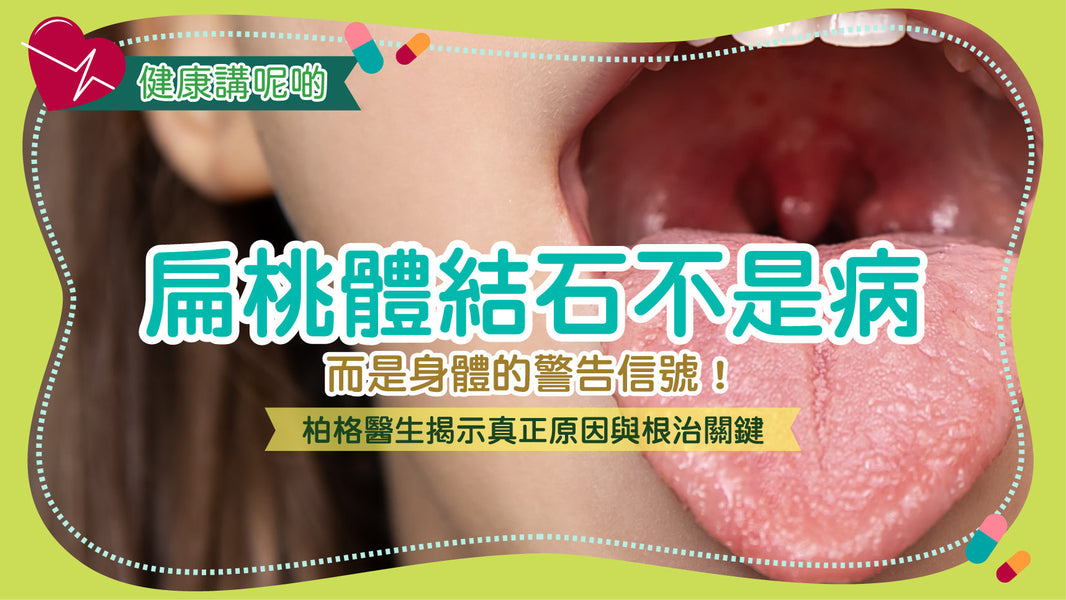 扁桃體結石不是病，而是身體的警告信號！柏格醫生揭示真正原因與根治關鍵