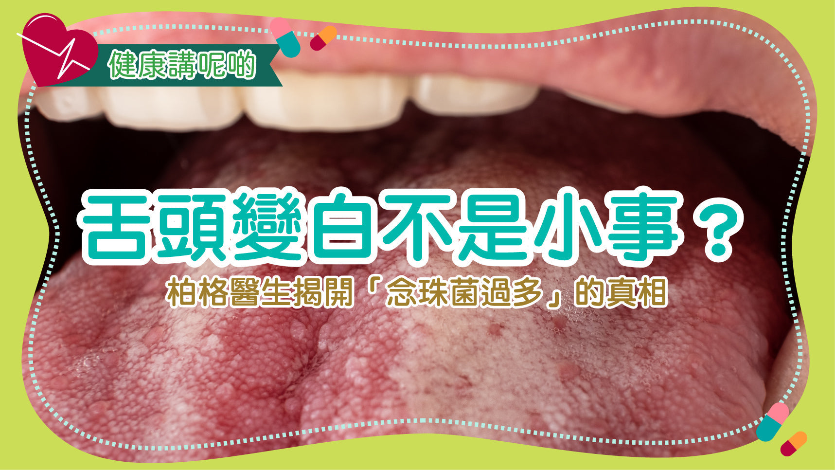 舌頭變白不是小事？柏格醫生揭開「念珠菌過多」的真相