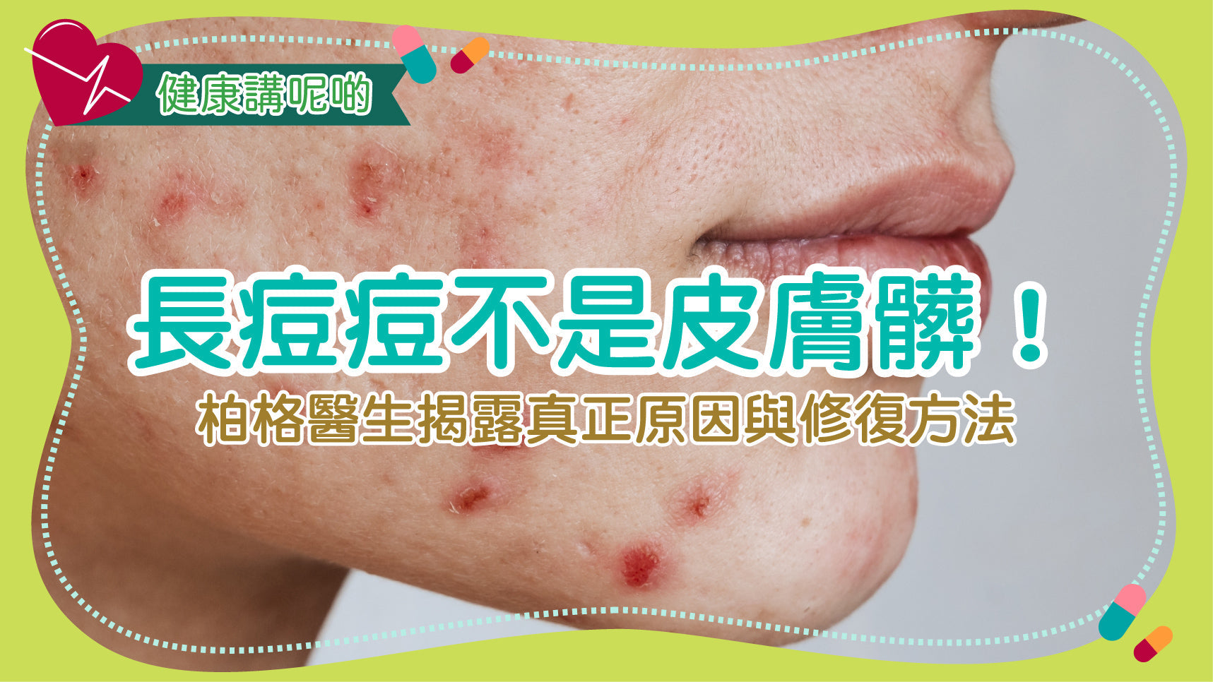 長痘痘不是皮膚髒！柏格醫生揭露真正原因與修復方法