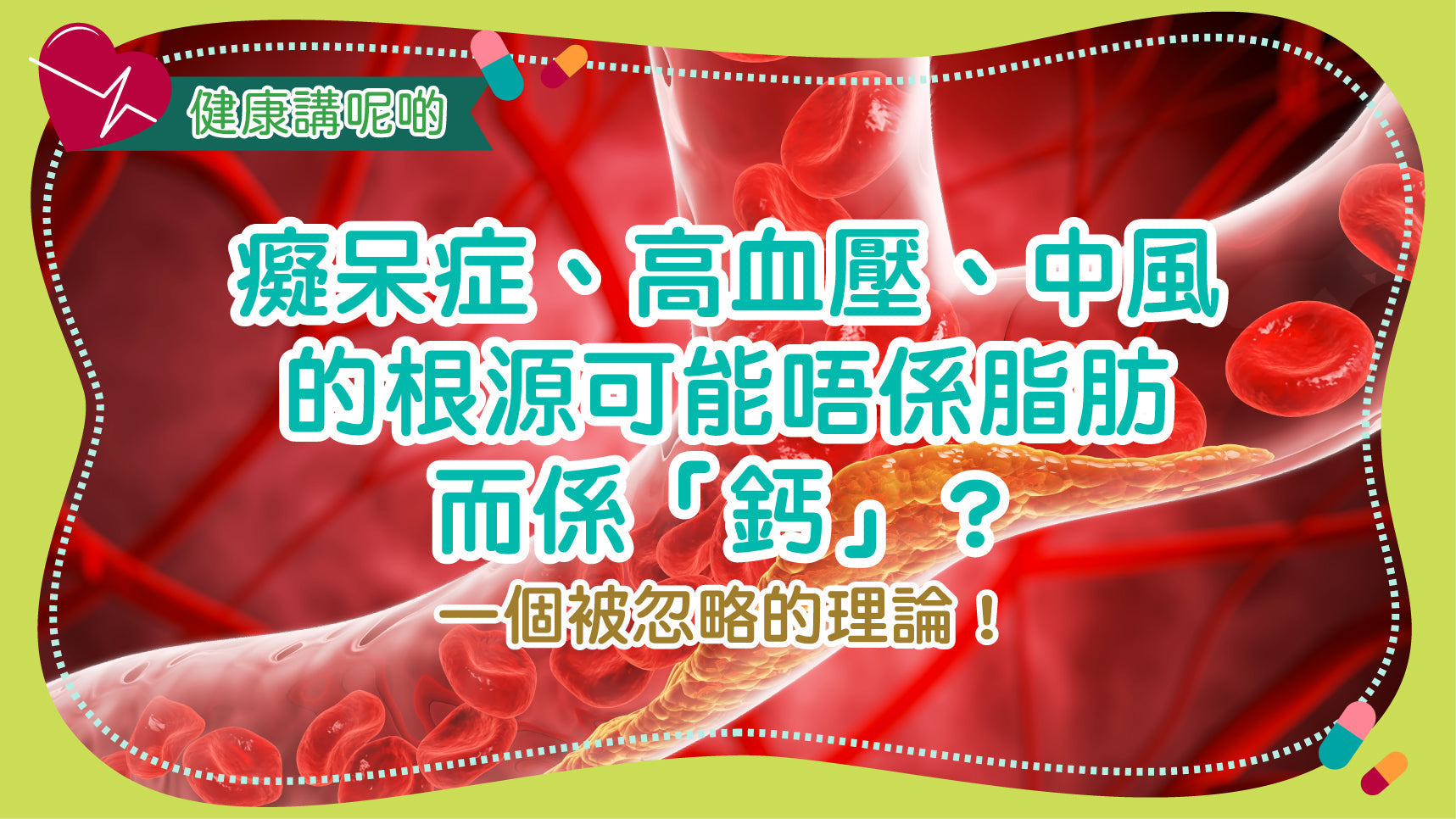 癡呆症、高血壓、中風的根源可能唔係脂肪，而係「鈣」？一個被忽略的理論！