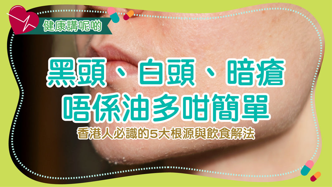 黑頭、白頭、暗瘡唔係油多咁簡單！香港人必識的5大根源與飲食解法